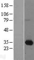 NMNAT1 Human Over-expression Lysates NM_022787