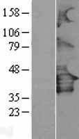P2Y12 (P2RY12) Human Over-expression Lysates NM_022788