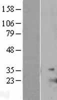 IL17E (IL25) Human Over-expression Lysates NM_022789