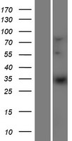 ELOVL1 Human Over-expression Lysates NM_022821