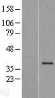 ls064839 fbxl17 human over expression lysates nm 022824 wb testing 1