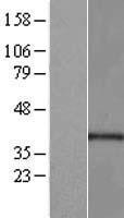 PORCN Human Over-expression Lysates NM_203473