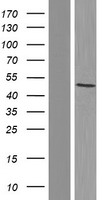 PORCN Human Over-expression Lysates NM_203474