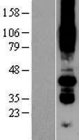 PORCN Human Over-expression Lysates NM_203475