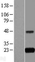 GNPNAT1 Human Over-expression Lysates NM_198066