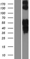 Islet 2 (ISL2) Human Over-expression Lysates NM_145805