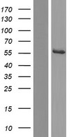 ls064850 agxt2l1 etnppl human over expression lysates nm 001146590 wb testing 2