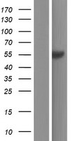 ls064850 agxt2l1 etnppl human over expression lysates nm 001146627 wb testing 3