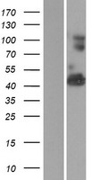 VWA1 Human Over-expression Lysates NM_022834