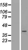 ARMCX5 Human Over-expression Lysates NM_022838