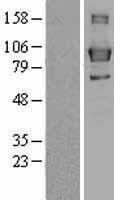 Lipin 3 (LPIN3) Human Over-expression Lysates NM_022896