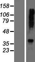 AGXT2 Human Over-expression Lysates NM_031900