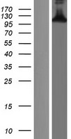 CTIP2 (BCL11B) Human Over-expression Lysates NM_138576
