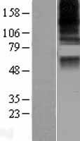ls064921 casd1 human over expression lysates nm 022900 wb testing 1