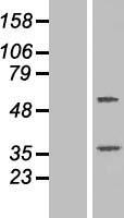 TTC23 Human Over-expression Lysates NM_001040657