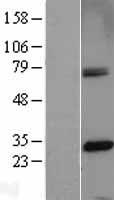 CENPH Human Over-expression Lysates NM_022909