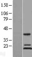 MRPS11 Human Over-expression Lysates NM_022839
