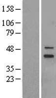 MRPS5 Human Over-expression Lysates NM_031902