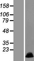 MRPL36 Human Over-expression Lysates NM_032479