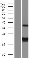 Mitochondrial ribosomal protein L11 (MRPL11) Human Over-expression Lysates NM_170738