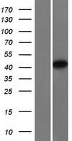 NDRG4 Human Over-expression Lysates NM_001130487