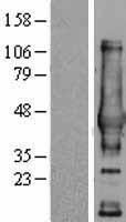 NDRG4 Human Over-expression Lysates NM_022910