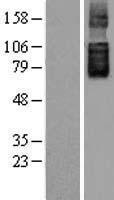 SLC26A6 Human Over-expression Lysates NM_134263