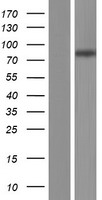 SLC26A6 Human Over-expression Lysates NM_134426