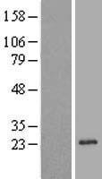 REEP1 Human Over-expression Lysates NM_022912
