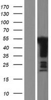 GPBP1 Human Over-expression Lysates NM_022913