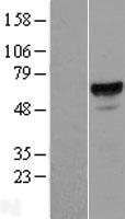 PTOP (ACD) Human Over-expression Lysates NM_001082486