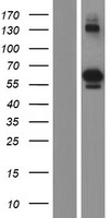 PTOP (ACD) Human Over-expression Lysates NM_001082487