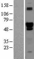 PTOP (ACD) Human Over-expression Lysates NM_022914
