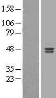 ALS2CR4 (TMEM237) Human Over-expression Lysates NM_152388