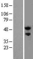 Nogo Receptor (RTN4R) Human Over-expression Lysates NM_023004