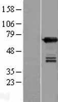 UPF3B Human Over-expression Lysates NM_023010