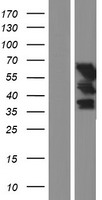 UPF3B Human Over-expression Lysates NM_080632
