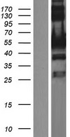 UPF3A Human Over-expression Lysates NM_080687