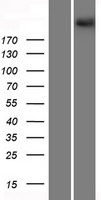 PCDH15 Human Over-expression Lysates NM_001142763