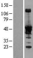 ls065220 nadk human over expression lysates nm 023018 wb testing 1