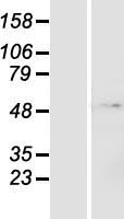 ls065243 znf643 zfp69b human over expression lysates nm 023070 wb testing 1
