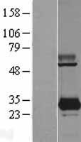 PYCR3 Human Over-expression Lysates NM_023078