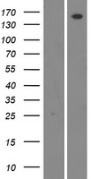 WNK4 Human Over-expression Lysates NM_032387