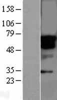 STK33 Human Over-expression Lysates NM_030906