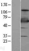 ZNF447 (ZSCAN18) Human Over-expression Lysates NM_001145543