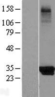ls065987 kctd14 human over expression lysates nm 023930 wb testing 1