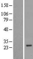 ZNF747 Human Over-expression Lysates NM_023931