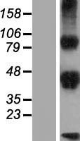 ls065989 dlk2 human over expression lysates nm 206539 wb testing 2
