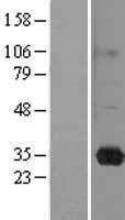 ls065997 rasl11b human over expression lysates nm 023940 wb testing 1