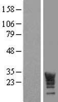 LRRC61 Human Over-expression Lysates NM_023942